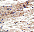 Immunohistochemical analysis of Ttc28 protein using Ttc28 antibody and paraffin-embedded zebrafish spinal cord tissue. HIER: boil tissue sections in pH8 EDTA for 20 min and allow to cool before testing.