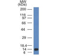 Western blot testing of a recombinant ALK partial protein using Anaplastic Lymphoma Kinase antibody (clone ALK/1032).