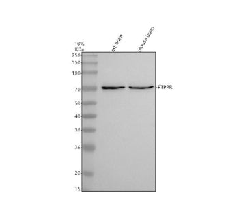 Western blot analysis of PTPRR using anti-PTPRR antibody. Electrophoresis was performed on a 10% SDS-PAGE gel at 80V (Stacking gel) / 120V (Resolving gel) for 2 hours. Lane 1: rat brain tissue lysates, Lane 2: mouse brain tissue lysates. After electrophoresis, proteins were transferred to a nitrocellulose membrane at 150 mA for 50-90 min. Blocked the membrane with 5% non-fat milk/TBS for 1.5 hour at RT.