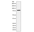 Western blot testing of human MCF7 cell lysate with EXOC3 antibody. Predicted molecular weight ~85 kDa.