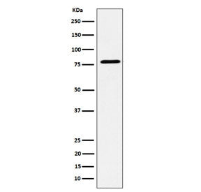 Western blot testing of human MCF7 cell lysate with EXOC3 antibody. Predicted molecular weight ~85 kDa.