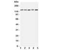 Western blot testing of Integrin alpha 7 antibody and Lane 1: 293T; 2: A431; 3: HeLa; 4: Jurkat; 5: Raji cell lysate. Expected/observed size ~129KD