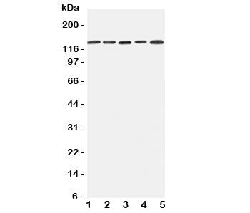 Western blot testing of Integrin alpha 7 antibody and Lane 1: 293T; 2: A431; 3: HeLa; 4: Jurkat; 5: Raji cell lysate. Expected/observed size ~129KD
