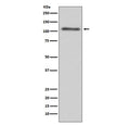 Western blot testing of human HepG2 cell lysate with C3 antibody. Expected molecular weight: ~185 kDa (alpha + beta chain), ~110 kDa (alpha chain), ~70 kDa (beta chain).