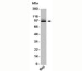 Western blot testing of human samples with TRIL antibody at 2ug/ml.