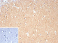 IHC staining of FFPE human brain tissue with DLL3 antibody (clone DLL3/9361). Inset: PBS used in place of primary Ab (secondary Ab negative control). HIER: boil tissue sections in pH 9 10mM Tris with 1mM EDTA for 20 min and allow to cool before testing.