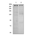 Western blot testing of human 1) HeLa and 2) RT4 cell lysate with 53BP1 antibody. Predicted molecular weight: ~214 kDa but may be observed at up to ~450 kDa.