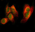 IF analysis of PAX8 using anti-PAX8 antibody (green) and anti-Beta Tubulin antibody (red). PAX8 was detected in immunocytochemical section of HELA cell. Enzyme antigen retrieval was performed using IHC enzyme antigen retrieval reagent for 15 mins. The cells were blocked with 10% goat serum. And then incubated with 5 ug/ml rabbit anti-PAX8 antibody and mouse anti-Beta Tubulin antibody overnight at 4oC. DyLight 488 Conjugated Goat Anti-Rabbit IgG and Cy3 Conjugated Goat Anti-Mouse IgG were used as secondary a