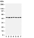 Western blot testing of CTBP1 antibody and Lane 1: rat brain; 2: rat testis; 3: rat ovary; 4: U87; 5: SW620; 6: HT1080; 7: COLO320 cell lysate. Predicted/observed molecular weight: ~47kDa.