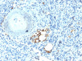 IHC testing of FFPE human spleen with recombinant TRAcP antibody (clone ACP5/2336R). Required HIER: boil tissue sections in 10mM citrate buffer, pH 6.0, for 10-20 min followed by cooling at RT for 20 min.
