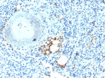 IHC testing of FFPE human spleen with recombinant TRAcP antibody (clone ACP5/2336R). Required HIER: boil tissue sections in 10mM citrate buffer, pH 6.0, for 10-20 min followed by cooling at RT for 20 min.