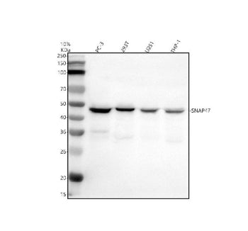 Western blot analysis of SNAP47 using anti-SNAP47 antibody. Electrophoresis was performed on a 10% SDS-PAGE gel at 80V (Stacking gel) / 120V (Resolving gel) for 2 hours. Lane 1: human PC-3 whole cell lysates, Lane 2: human 293T whole cell lysates, Lane 3: human U251 whole cell lysates, Lane 4: human THP-1 whole cell lysates. After electrophoresis, proteins were transferred to a nitrocellulose membrane at 150 mA for 50-90 min. Blocked the membrane with 5% non-fat milk/TBS for 1.5 hour at RT.