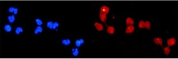 Immunofluorescent staining of FFPE human U-2 OS cells with DDB2 antibody (red) and DAPI nuclear stain (blue). HIER: steam section in pH6 citrate buffer for 20 min.