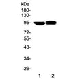 Western blot testing of Prolactin Receptor antibody and Lane 1: human HeLa; 2: human MCF-7 cell lysate. Expected molecular weight: 70-117 kDa depending on glycosylation level.