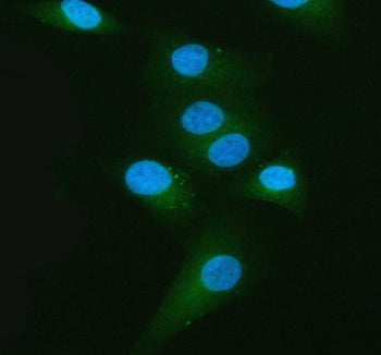 Immunofluorescent staining of Melanophilin/MLPH using anti-MLPH antibody (green). Melanophilin/MLPH was detected in an immunocytochemical section of cells. Enzyme antigen retrieval was performed using IHC enzyme antigen retrieval reagent for 15 mins. The cells were blocked with 10% goat serum. And then incubated with 5 ug/ml rabbit anti-MLPH antibody overnight at 4oC. DyLight 488 Conjugated Goat Anti-Rabbit IgG was used as secondary antibody at 1:500 dilution and incubated for 30 min at 37oC.