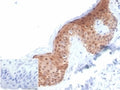 IHC staining of FFPE human skin with SERPINB5 antibody (clone SERPINB5/4972). Negative control inset: PBS used instead of primary antibody to control for secondary Ab binding. HIER: boil tissue sections in pH 9 10mM Tris with 1mM EDTA for 20 min and allow to cool before testing.