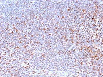 IHC staining of FFPE human tonsil with Nuclear Marker antibody (clone NM2984R). HIER: boil tissue sections in pH6, 10mM citrate buffer, for 10-20 min and allow to cool prior to testing.