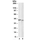 Western blot testing of KELLY [A] and U251-MG [B] lysates with CX3CR1 antibody at 2ug/ml. Predicted molecular weight ~40kDa.