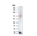 Western blot testing of human pancreas tissue lysate with Colipase antibody (clone CLPS/9027). Predicted molecular weight ~12 kDa.