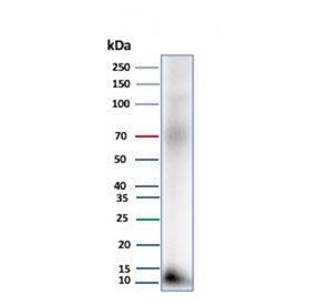 Western blot testing of human pancreas tissue lysate with Colipase antibody (clone CLPS/9027). Predicted molecular weight ~12 kDa.