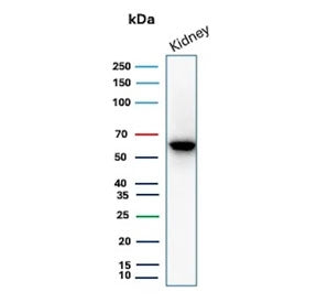 Western blot testing of human kidney tissue lysate with Occludin antibody. Predicted molecular weight ~59 kDa.
