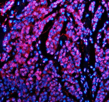 Immunofluorescent staining of PABPN1 using anti-PABPN1 antibody (red). PABPN1 was detected in a paraffin-embedded section of human testis tissue. Heat mediated antigen retrieval was performed in EDTA buffer (pH 8.0, epitope retrieval solution). The tissue section was blocked with 10% goat serum. The tissue section was then incubated with 5 ug/ml rabbit anti-PABPN1 antibody overnight at 4oC. Cy3 Conjugated Goat Anti-Rabbit IgG was used as secondary antibody at 1:500 dilution and incubated for 30 min at 37oC.