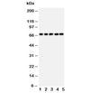 Western blot testing of SHP2 antibody and rat samples 1: heart; 2: skeletal muscle; 3: brain; and human samples 4: HeLa; 5: A549 cell lysate. Predicted molecular weight: ~68 kDa.