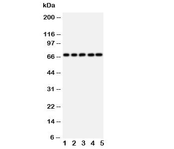 Western blot testing of SHP2 antibody and rat samples 1: heart; 2: skeletal muscle; 3: brain; and human samples 4: HeLa; 5: A549 cell lysate. Predicted molecular weight: ~68 kDa.