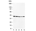 Western blot testing of CCR10 antibody and Lane 1: HeLa; 2: SW620; 3: A549; 4: MM231; 5: SMMC-7721 cell lysate. Predicted molecular weight ~38 kDa.