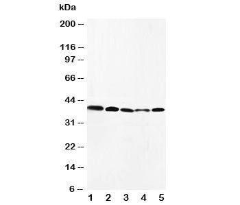 Western blot testing of CCR10 antibody and Lane 1: HeLa; 2: SW620; 3: A549; 4: MM231; 5: SMMC-7721 cell lysate. Predicted molecular weight ~38 kDa.