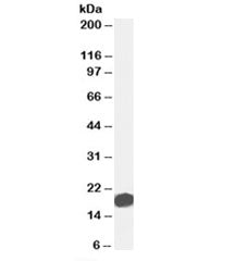 Western blot testing of human duodenum lysate with AGR2 antibody at 0.01ug/ml. Expected molecular weight: 17-20 kDa.