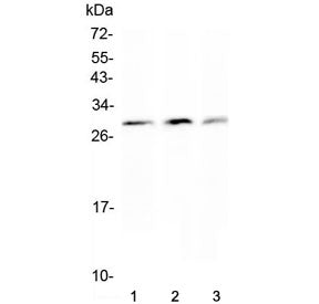 Western blot testing of Kallikrein-2 antibody and Lane 1: PANC; 2: HeLa; 3: 293T cell lysate. Predicted molecular weight: 17-29 kDa (multiple isoforms).