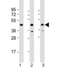 Western blot testing of human 1) 293T/17, 2) Jurkat and 3) K562 cell lysate with PHF6 antibody at 1:2000. Predicted molecular weight: 41 kDa.