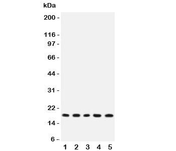 Western blot testing of IL-2 antibody and rat samples 1: thymus; 2: liver; 3: NRK; 4: PC12; 5: RH35 lysate. Predicted molecular weight: 14-18kDa.