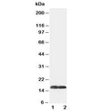 Western blot testing of SOD1 antibody and Lane 1: COLO320; 2: SMMC-7721 cell lysate. Predicted molecular weight: ~16 kDa.