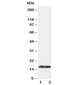 Western blot testing of SOD1 antibody and Lane 1: COLO320; 2: SMMC-7721 cell lysate. Predicted molecular weight: ~16 kDa.