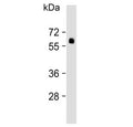 Western blot testing of human lung lysate with SMAD6 antibody. Observed molecular weight: 50~60 kDa.