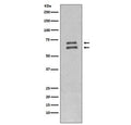 Western blot testing of human HeLa cell lysate with Lamin A/C antibody. Predicted molecular weight ~74 & 65 kDa.