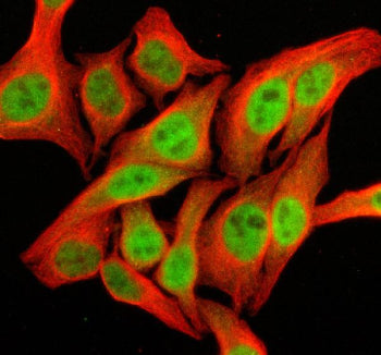 Immunofluorescent staining of SFMBT2 using anti-SFMBT2 antibody (green) and anti-Beta Tubulin antibody (red). SFMBT2 was detected in an immunocytochemical section of Hela cells. Enzyme antigen retrieval was performed using IHC enzyme antigen retrieval reagent for 15 mins. The cells were blocked with 10% goat serum. And then incubated with 5 ug/ml rabbit anti-SFMBT2 antibody and mouse anti-Beta Tubulin antibody overnight at 4oC.