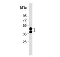 Western blot testing of human liver tissue lysate with Haptoglobin antibody. Predicted molecular weight: 45, 38 kDa (two isoforms).
