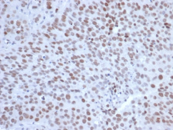 IHC staining of FFPE human tonsil tissue with EZH2 antibody (clone EZH2/6991). HIER: boil tissue sections in pH 9 10mM Tris with 1mM EDTA for 20 min and allow to cool before testing.