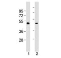 Western blot testing of mouse 1) brain and 2) liver tissue lysate with Gamma Tubulin antibody at 1:2000. Predicted molecular weight ~51 kDa.