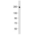 Western blot testing of human lung lysate with COL14A1 antibody at 1:2000. Predicted molecular weight ~194 kDa.