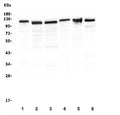 Western blot testing of RIAM antibody and human 1) ThP-1, 2) Jurkat, 3) Raji, 4) U937, 5) rat thymus and 6) mouse thymus lysate. Predicted molecular weight ~73~110 kDa.