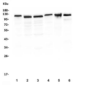 Western blot testing of RIAM antibody and human 1) ThP-1, 2) Jurkat, 3) Raji, 4) U937, 5) rat thymus and 6) mouse thymus lysate. Predicted molecular weight ~73~110 kDa.