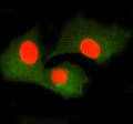 Immunofluorescent staining of SMTN using anti-SMTN antibody (red) and anti-Beta Tubulin antibody (green). SMTN was detected in immunocytochemical section of cell. Enzyme antigen retrieval was performed using IHC enzyme antigen retrieval reagent for 15 mins. The cells were blocked with 10% goat serum. And then incubated with 5 ug/ml rabbit anti-SMTN antibody and mouse anti-Beta Tubulin antibody overnight at 4oC.