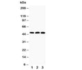 Western blot testing of HYAL3 antibody and Lane 1: 22RV; 2: HeLa; 3: V20S cell lysate. Expected size: ~47KD