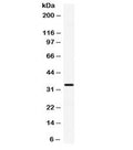 Western blot testing of human HeLa cell lysate with CXCL10 antibody. Expected molecular weight 8~11 kDa, observed here at ~34 kDa.
