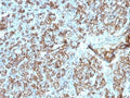 IHC testing of FFPE human tonsil tissue with HLA-DP/DQ/DR antibody (clone CR3/43). Required HIER: boil tissue sections in 10mM citrate buffer, pH 6, for 10-20 min.