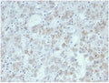 IHC staining of FFPE human adrenal gland tissue with recombinant IL15 antibody (clone IL15/7048R). HIER: boil tissue sections in pH 9 10mM Tris with 1mM EDTA for 20 min and allow to cool before testing.